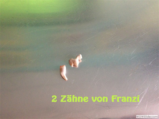 161113_2-Zaehne-von-Franzi